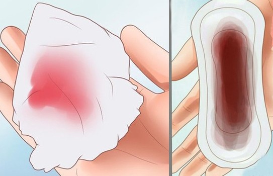 خونريزي پس از زايمان